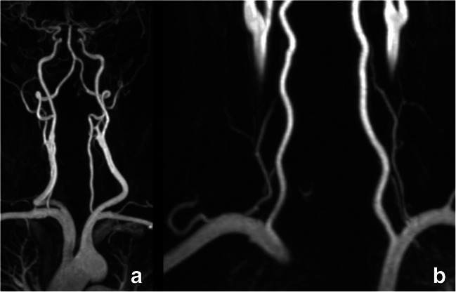 Fig. 11