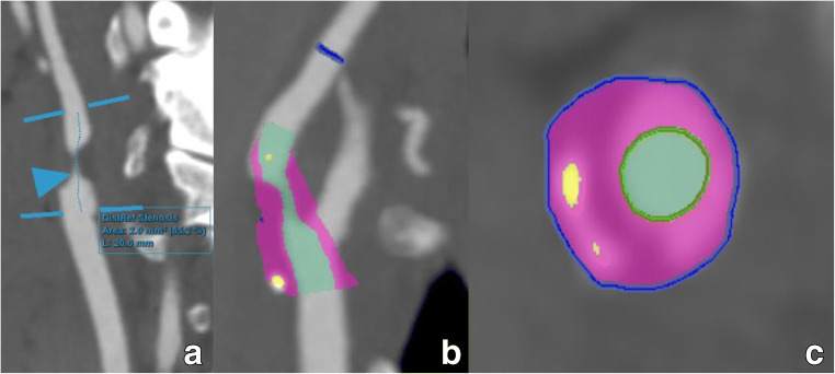 Fig. 12