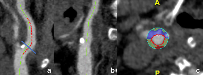 Fig. 10