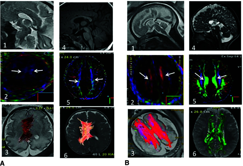 FIG 1.