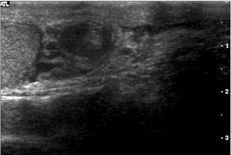 FIG. 1
