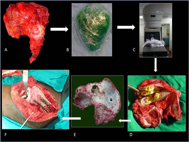 Fig. 1 A-F