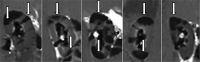 Fig 5