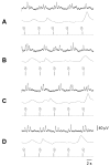 Fig. 21