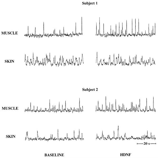 Fig. 19