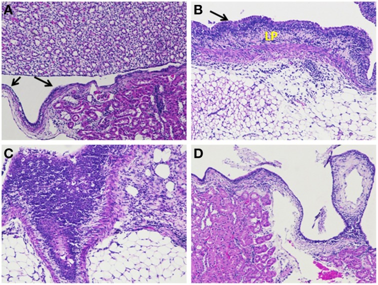 Figure 11