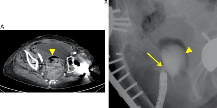 Fig. 1