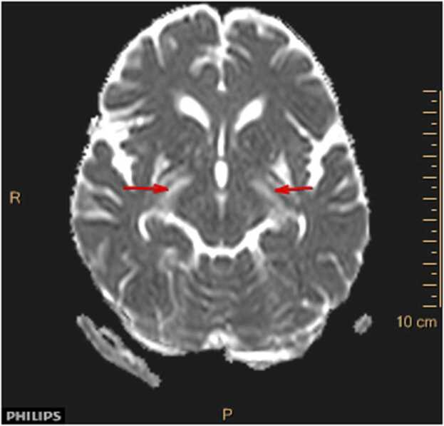 Fig. 3