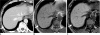Fig. 12