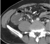 Fig. 11