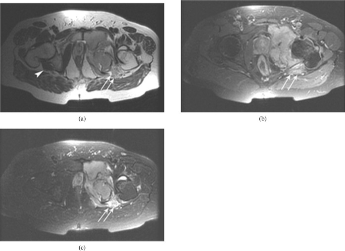 Figure 13