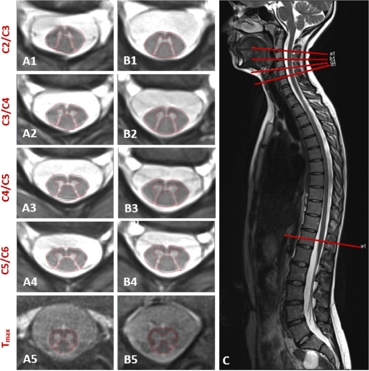 Fig. 1