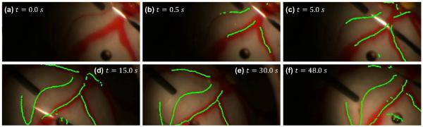 Fig. 4