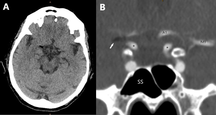 Figure 1