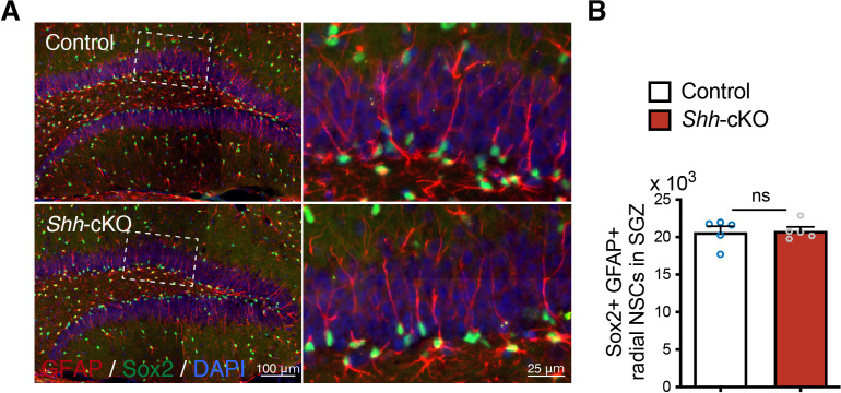 Figure 3—figure supplement 1.