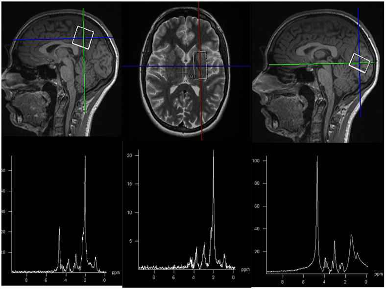 Figure 1: