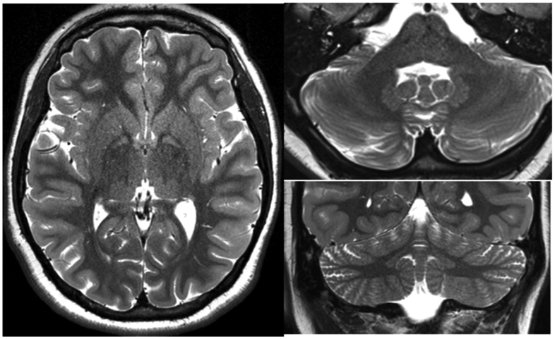 Figure 2: