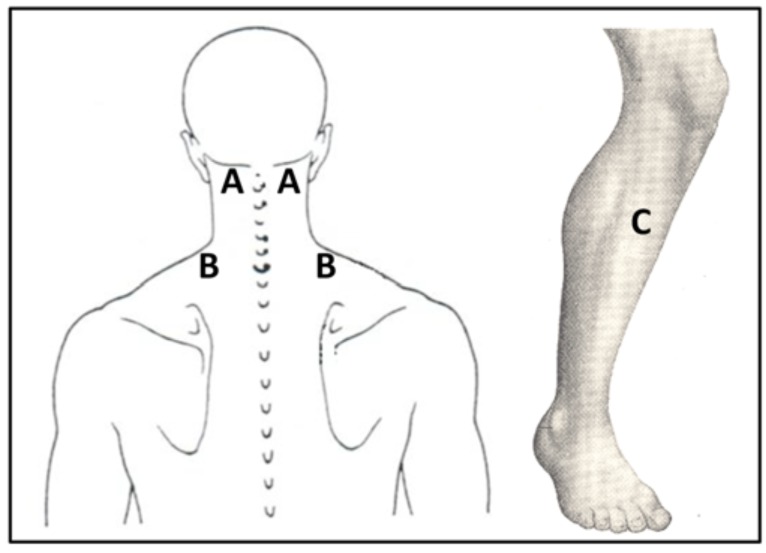 Fig. (1)