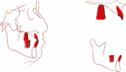 Fig. 11