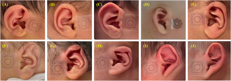 FIGURE 3