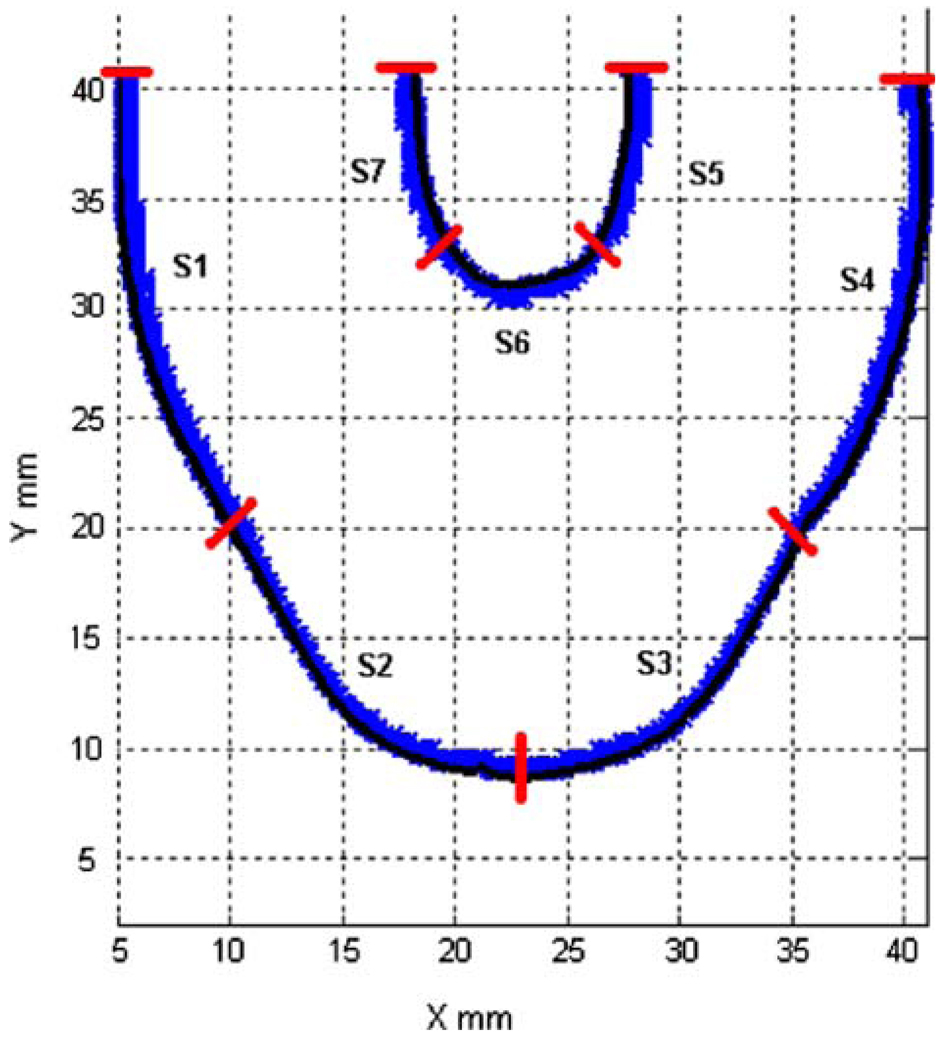 FIGURE 14