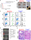 Figure 5. B-ALL development in Rosa26-mJak3V670A+Mb1-Cre+ Pax5+/− mice. A, Overall survival of Rosa26-mJak3V670A+Mb1-Cre+Pax5+/− (red line; n = 10) and Rosa26-mJak3V670A+Pax5+/− mice (blue line; n = 10), none of them exposed to common infections. Log-rank (Mantel–Cox) test, P < 0.0001. B, Photographs of the LNs of 1,7 month-old sibling Rosa26-mJak3V670A+Mb1-Cre+Pax5+/− (red arrow) and Rosa26-mJak3V670A+Pax5+/− mice (blue arrow). Scale bars, 1 cm. C, Flow cytometric analysis of B-cell subsets in diseased Rosa26-mJak3V670A+Mb1-Cre+Pax5+/− mice. Representative plots of B cell from the PB, BM, and LNs are shown. B cells from a control littermate Rosa26-mJak3V670A+Pax5+/− mouse are shown for reference. Tracking of the GFP marker for mJak3V670A transgene expression in the leukemic B cells of Rosa26-mJak3V670A+Mb1-Cre+Pax5+/− mice shows that all tumor cells are GFP+ in 100% (10/10) of the mice studied. Flow cytometric images are representative of 10 mice analyzed. D, BCR clonality in Rosa26-mJak3V670A+Mb1-Cre+Pax5+/− mice. PCR analysis of BCR gene rearrangements in infiltrated BM and LNs of diseased mice. Sorted CD19+ B cells from spleens of healthy mice served as a control for polyclonal BCR rearrangements. DP T cells from the thymus of healthy mice served as a negative control. Leukemic mice show increased clonality within their BCR repertoire (indicated by colored squares). E, An example of hematoxylin and eosin staining of liver and kidney from a tumor-bearing Rosa26-mJak3V670A+Mb1-Cre+Pax5+/− mouse shows infiltrates of relatively uniform lymphoid cells with immature appearance. The same tissues from a control littermate Rosa26-mJak3V670A+Pax5+/− mouse are shown as reference.