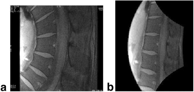 FIG. 11