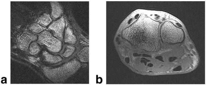 FIG. 9