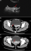 Fig. 2