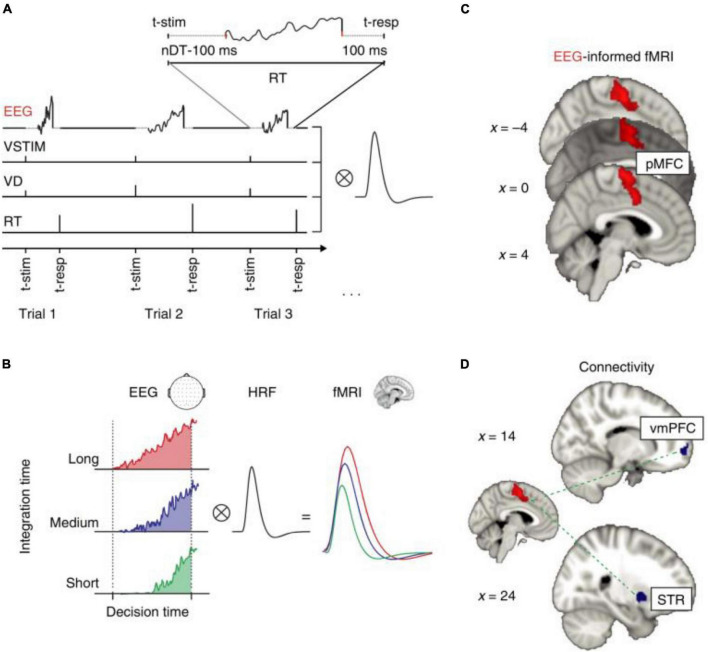 Simultaneous Electroencephalography Functional Magnetic Resonance Imaging For Assessment Of