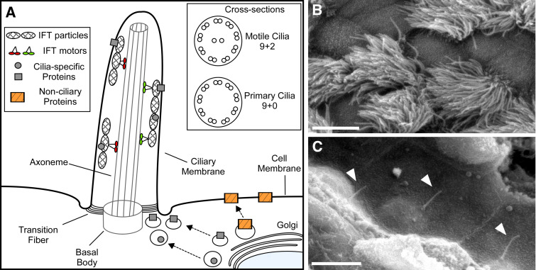 Neuronal ciliary signaling in homeostasis and disease - PMC