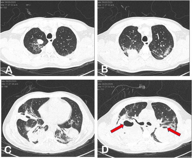 Fig. 2