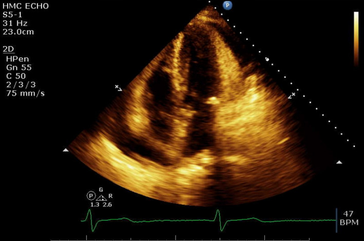 FIGURE 4