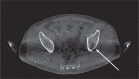 eFigure 1