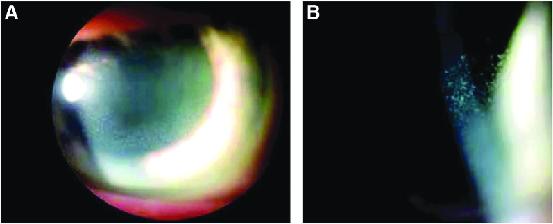 FIG. 1.