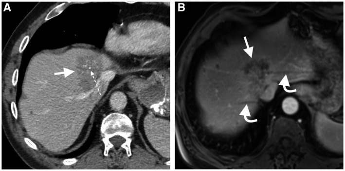 FIG 2