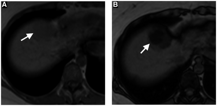 FIG 1