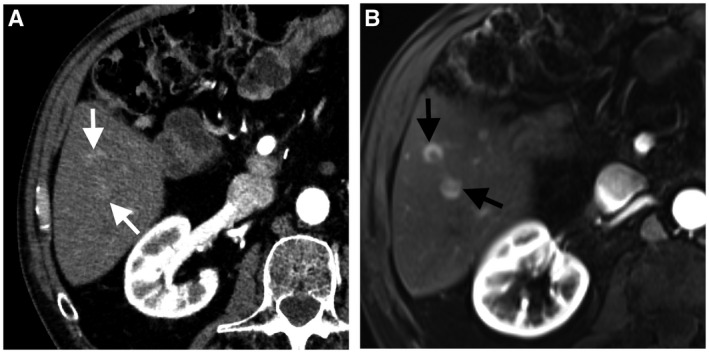 FIG 3