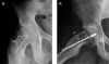 Figure 5A and 5B