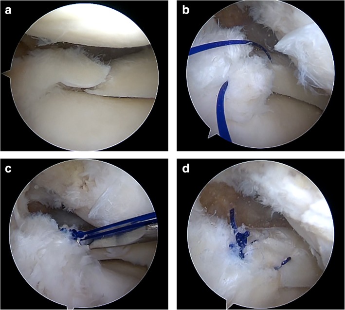 Fig. 2