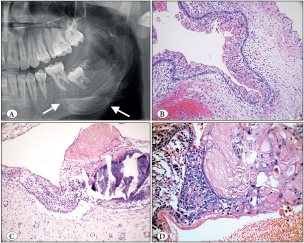 Figure 11