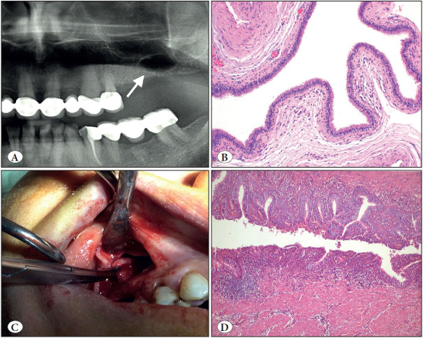 Figure 13