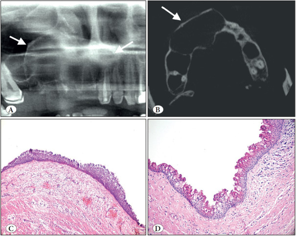 Figure 12