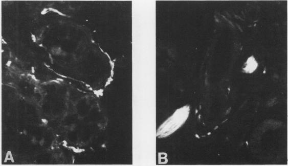 graphic file with name thorax00209-0015-a.jpg