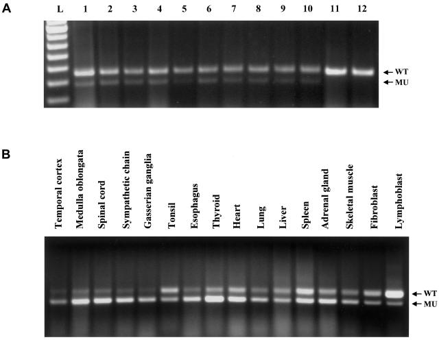 Figure  2