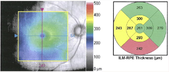 Fig. 1