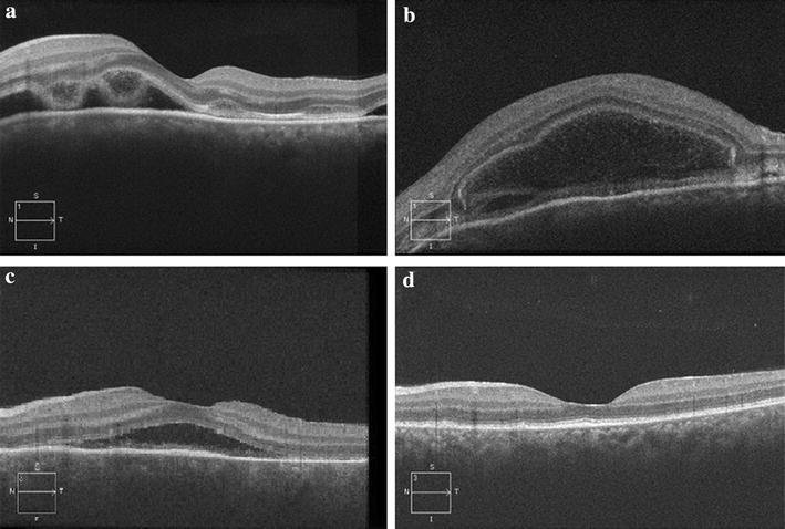 Fig. 3