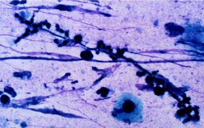 FIG. 18
