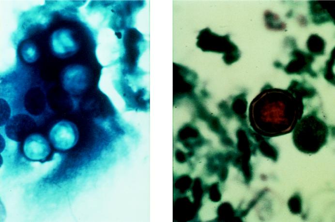 FIG. 25