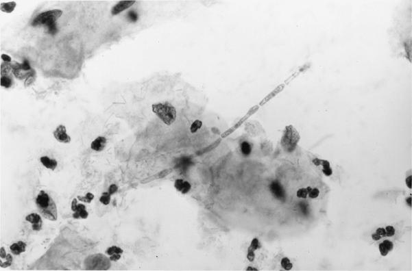 FIG. 17